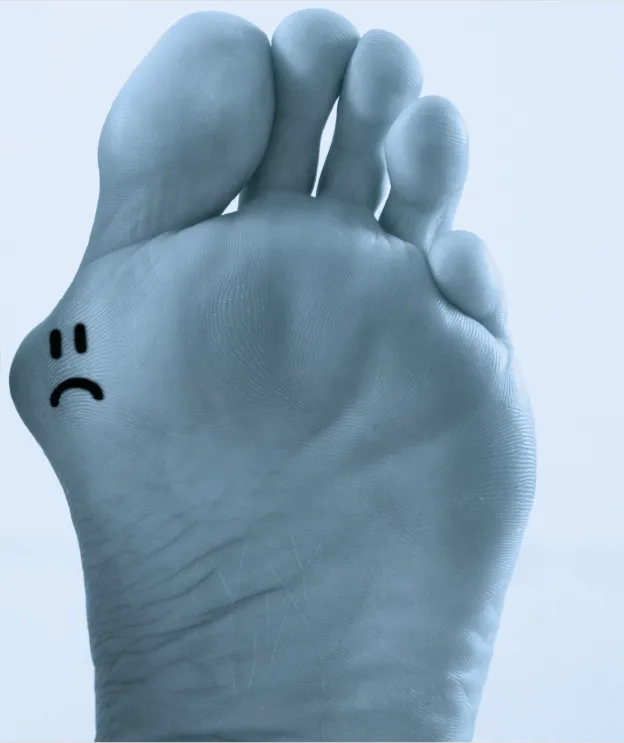 Ein ungesunder, möglicherweise erkrankter Fuß mit einem traurigen Smiley, der Unwohlsein und gesundheitliche Probleme darstellt
